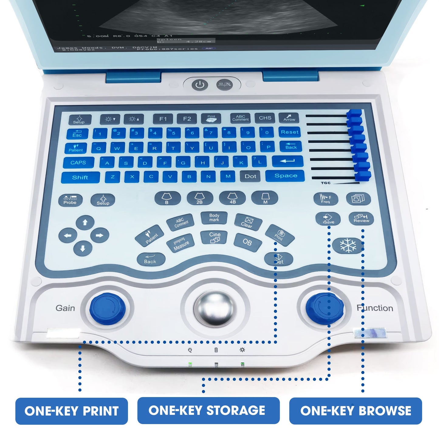 Prime 56X Ultrasound Scanner